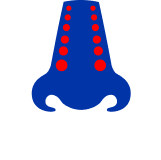 Medzi hlavné príznaky zápalu prínosových dutín patrí upchatý nos.